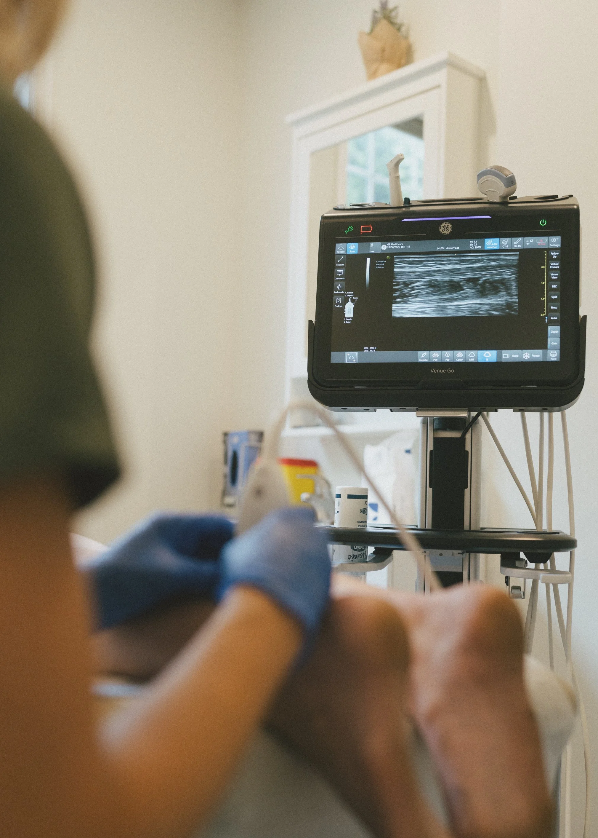 Dr. Rollheiser, ND performing ultrasound-guided pain management injection with GE Venue Go ultrasound machine, for PRP (platelet rich plasma), Hyaluronic Acid (HA), prolotherapy, corticosteroids, perineural / scar tissue therapy, and trigger point.