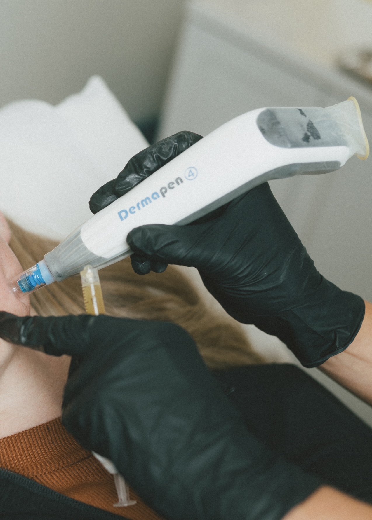 Dr. Rollheiser, ND performing microneedling using the DP4 device.