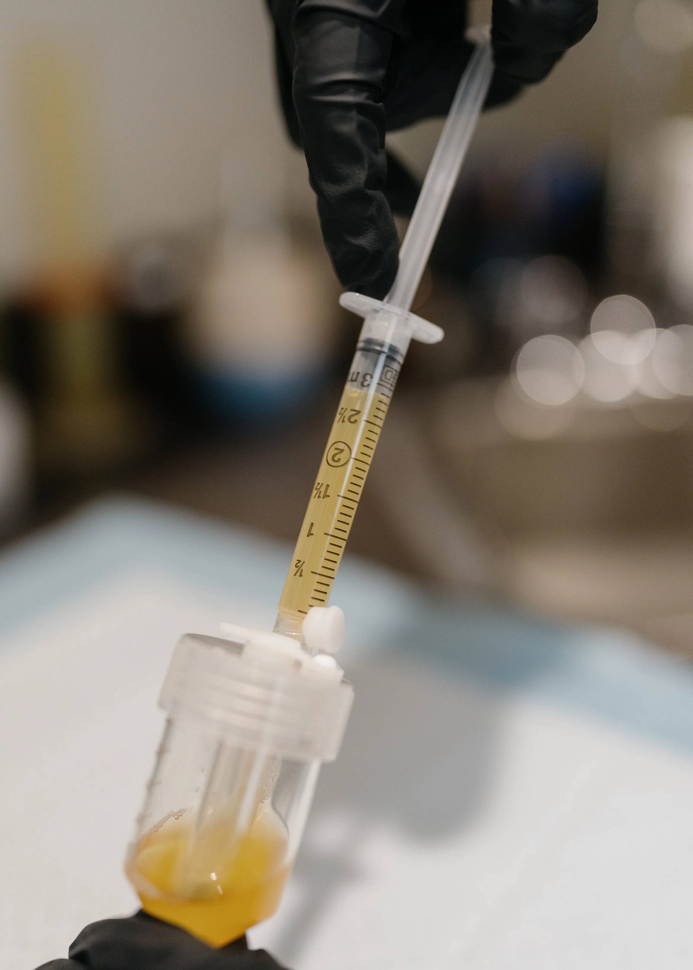 Dr. Rollheiser, ND using PRP (platelet-rich plasma) for facial and neck rejuvenation, as well as hair loss.