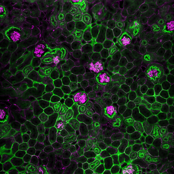 CD31 albumin 1slice.png