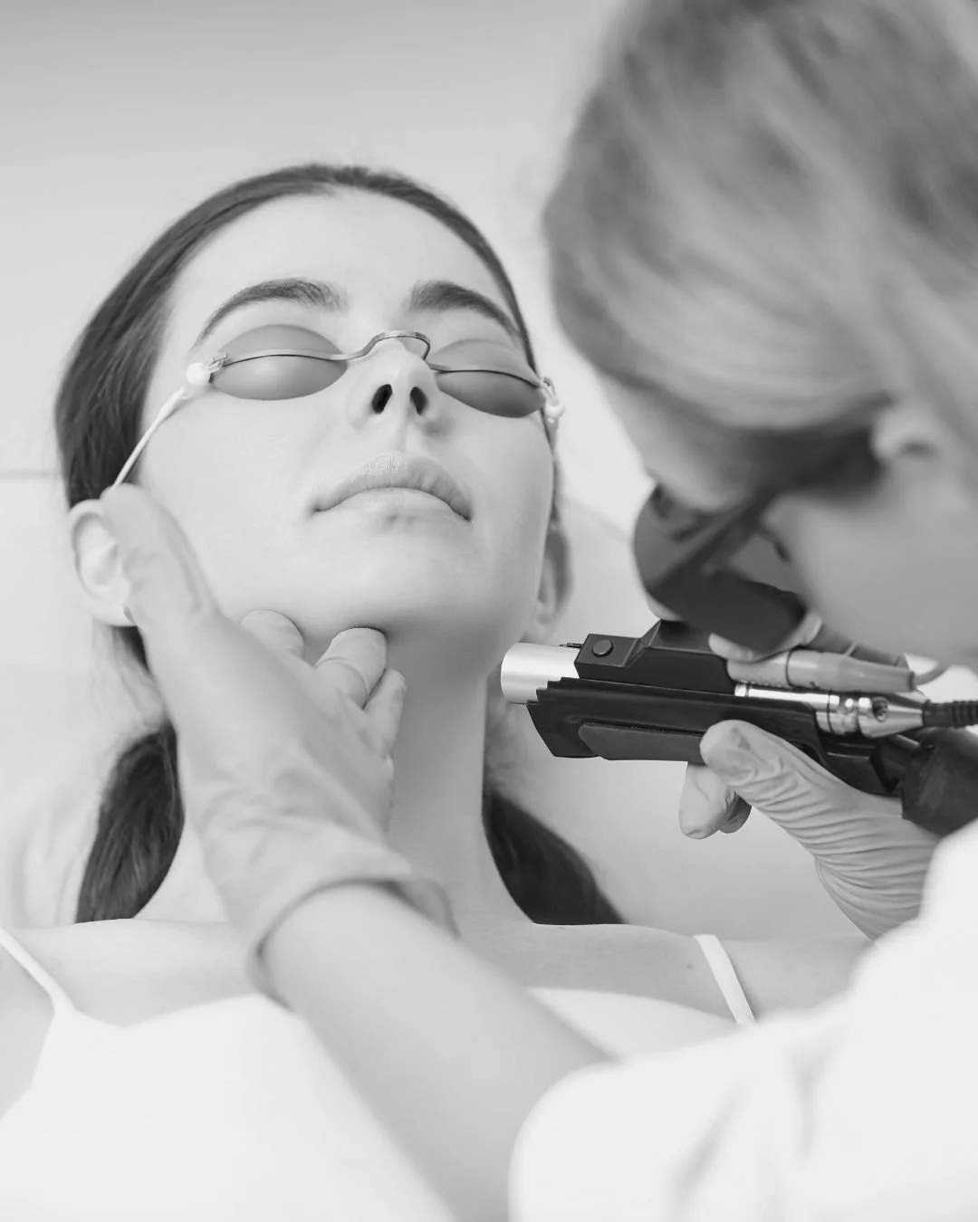 CO2 laser skin resurfacing treatment at Amaraah Haus medspa in West Covina