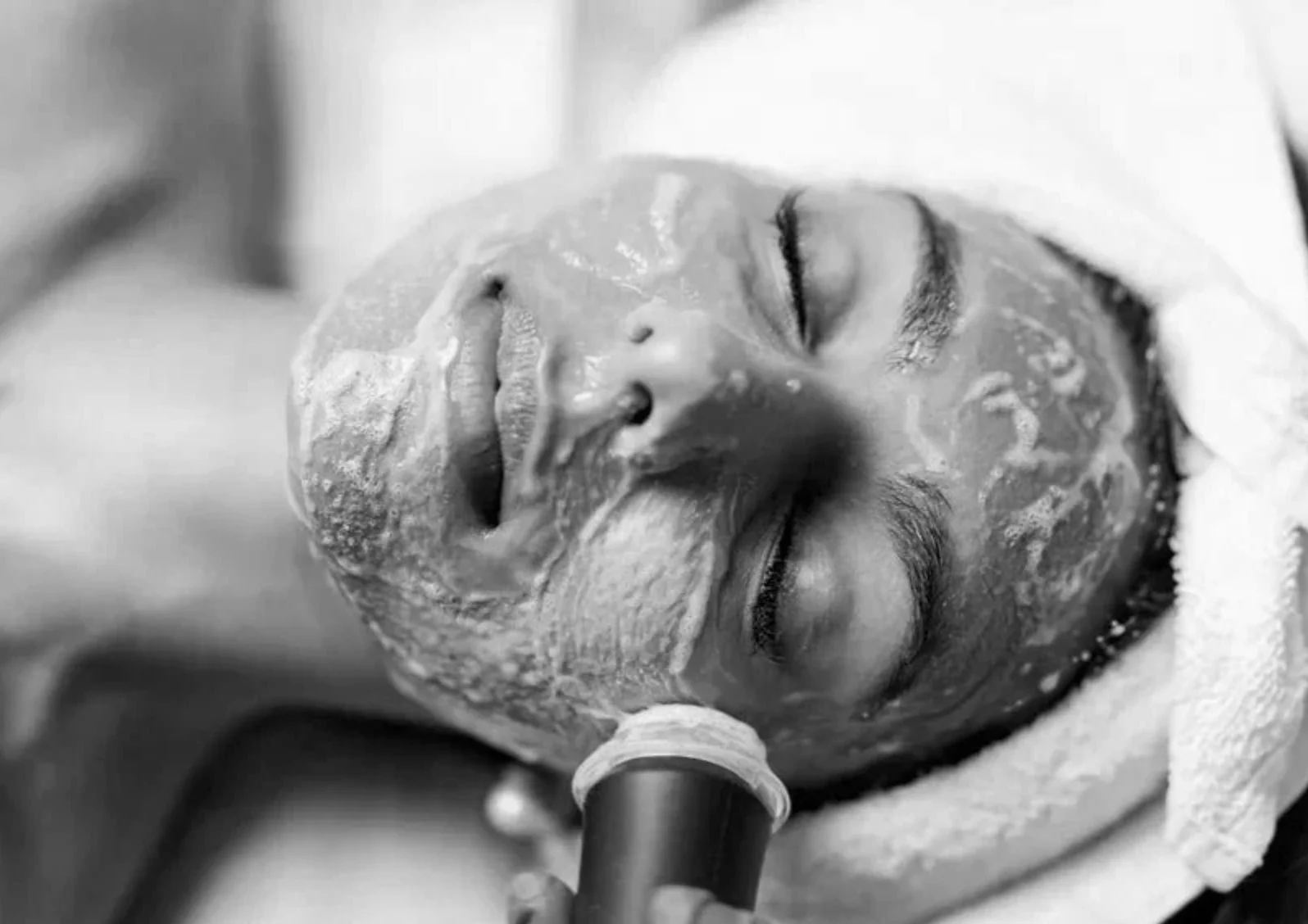 Close-up of a person's face with eyes closed, receiving medical treatment through a tube in the nose, with a facial mask, in black and white.
