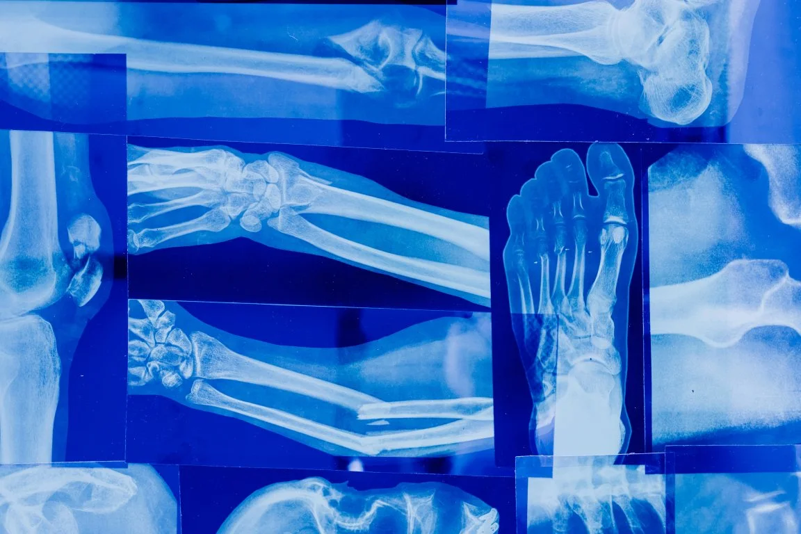 Orthopedic Conditions