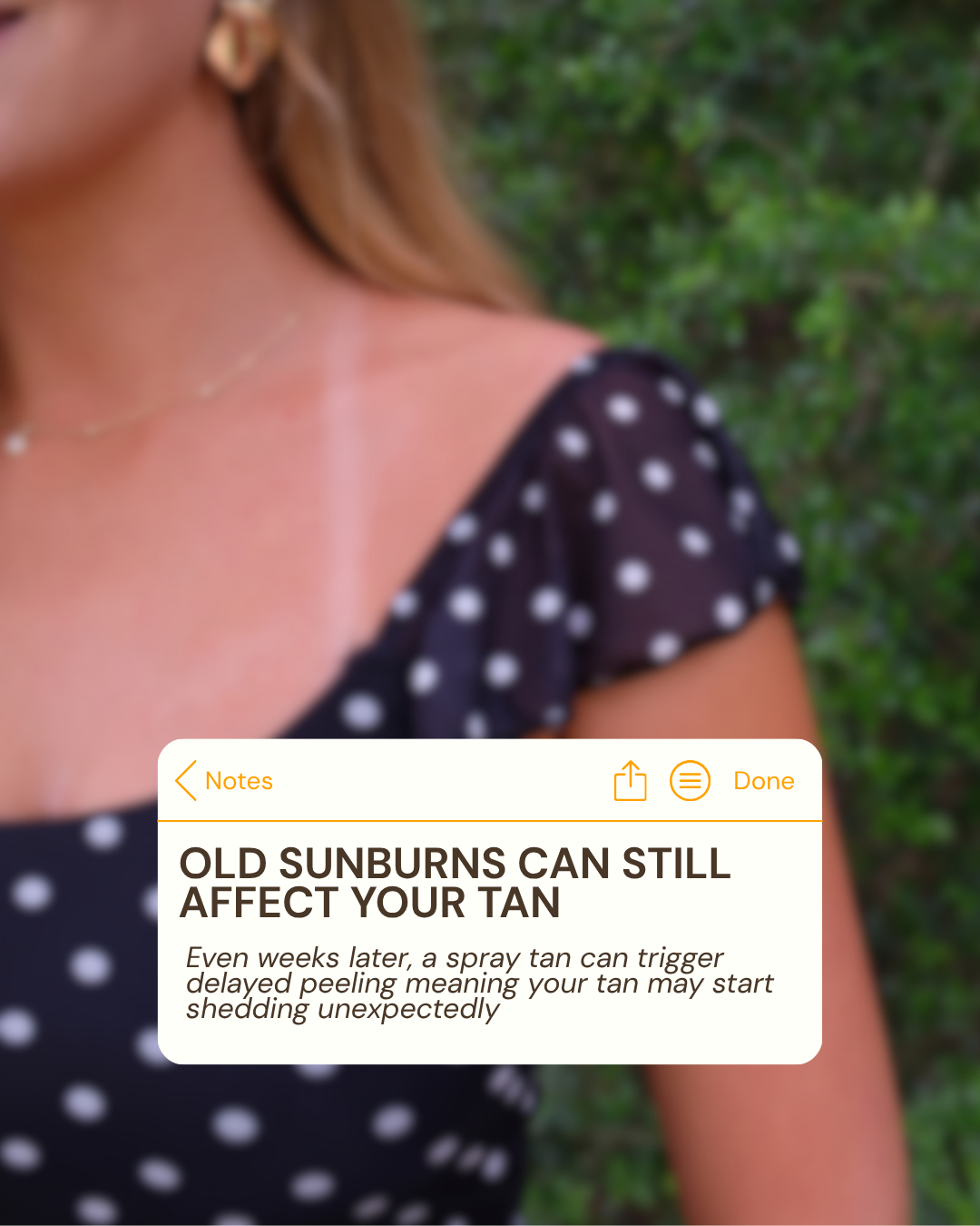 Important spray tan prep tip from Glow & Bask: old sunburns and peeling skin can affect how your custom spray tan develops and fades. Luxury bridal spray tans, mobile spray tans, and airbrush tanning in Friendswood, Pearland, and League City TX.