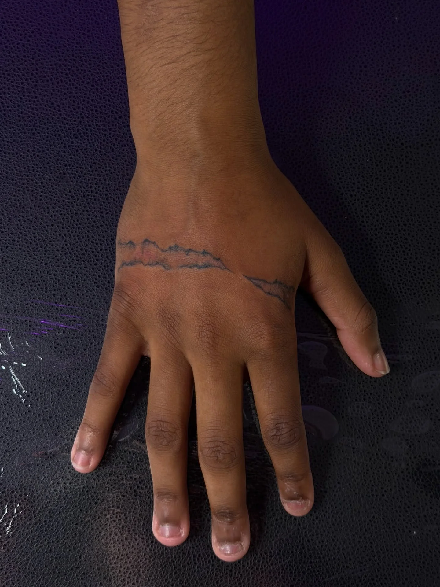 Freehand Deku scars!