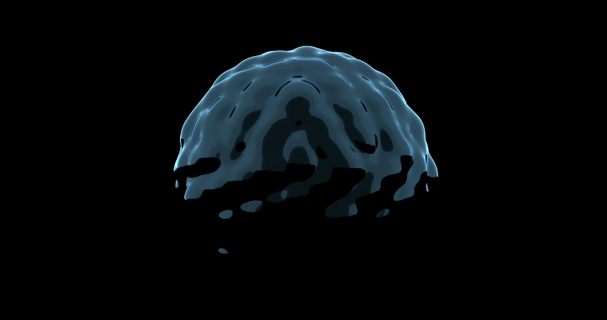 How Hearing Loss is Directly Linked to Dementia and What You Can Do About It.