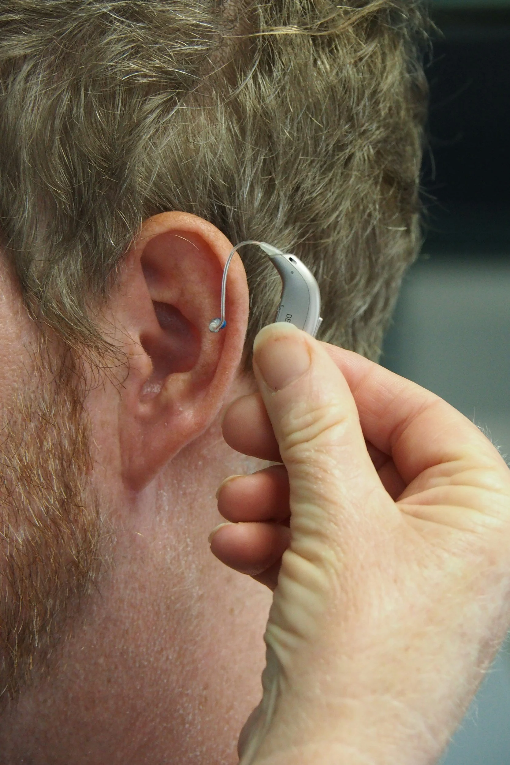 Is Hearing Loss Reversible? A Guide to Causes, Treatments, and Hope