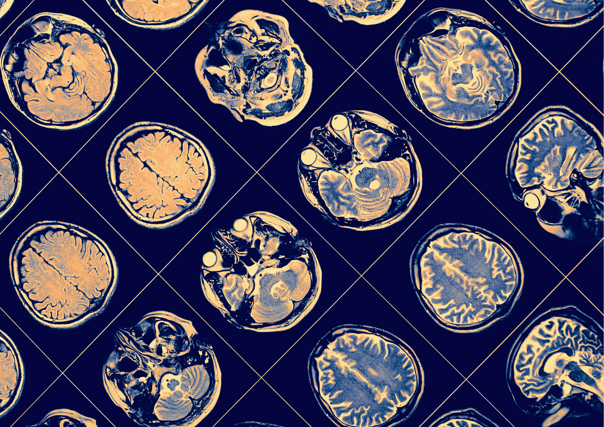 ПЪРВА ПОМОЩ ПРИ ГЪРЧ