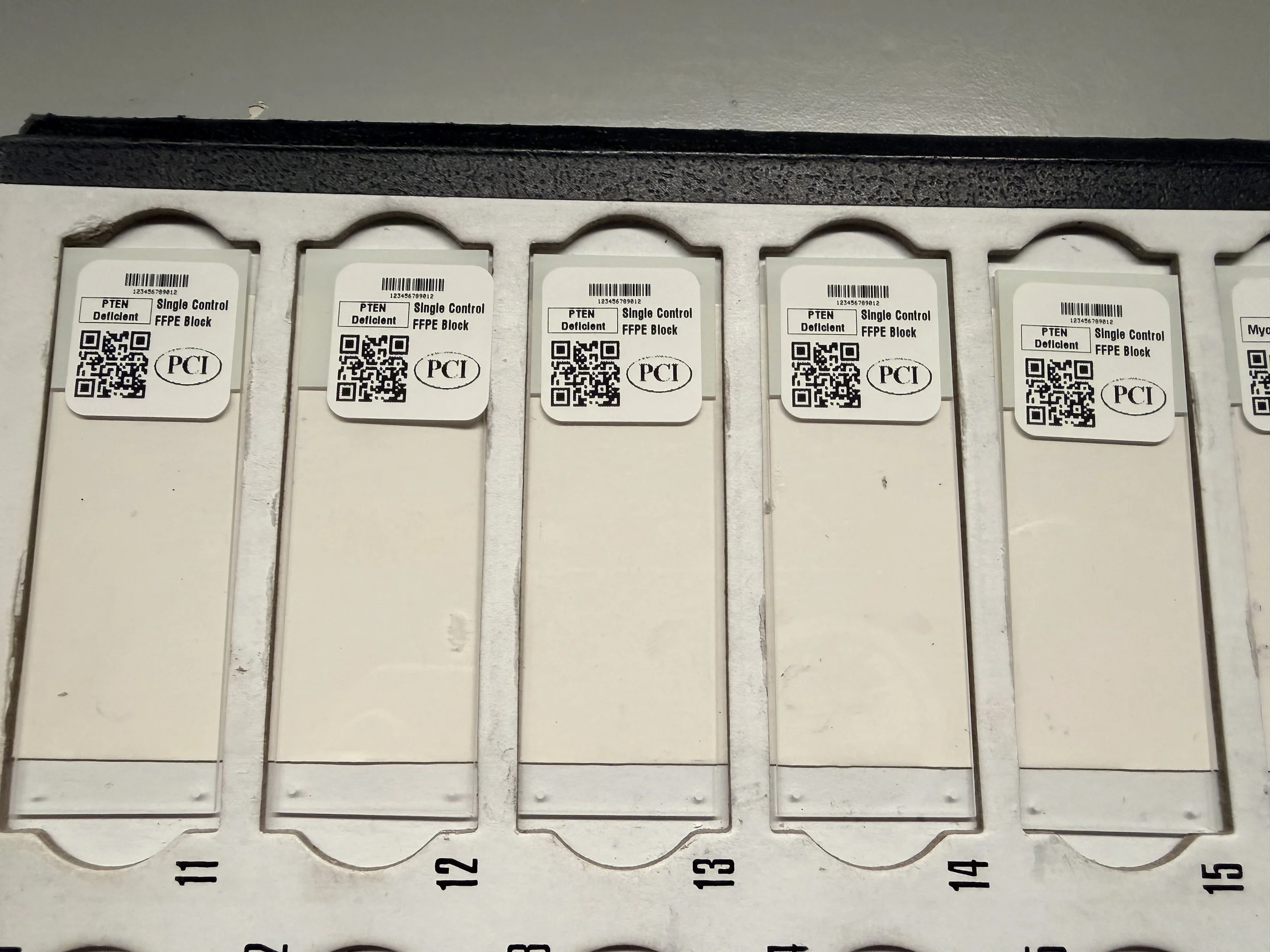 PTEN deficient single slide.JPG