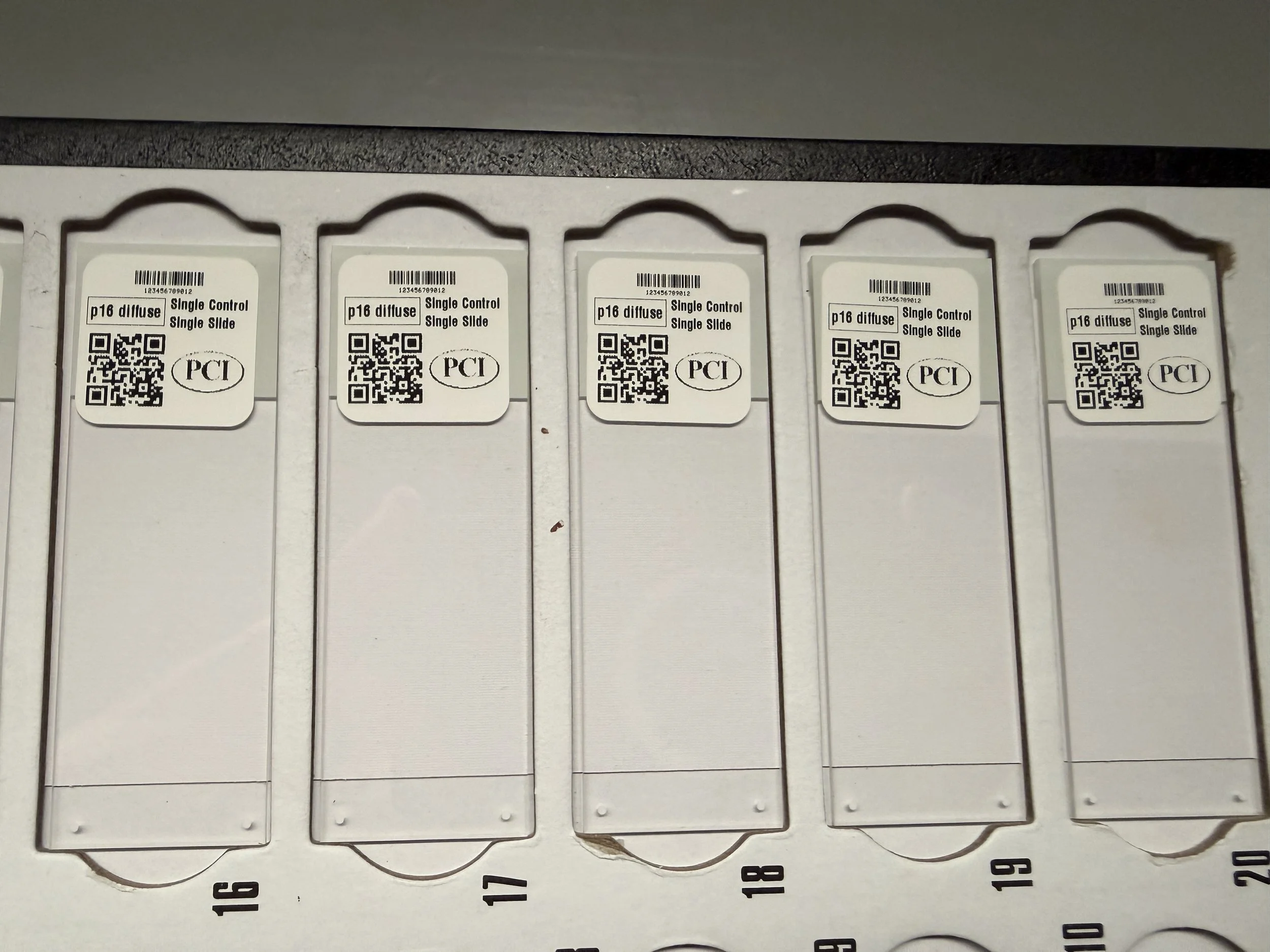 p16 diffuse singel control single slide.JPG
