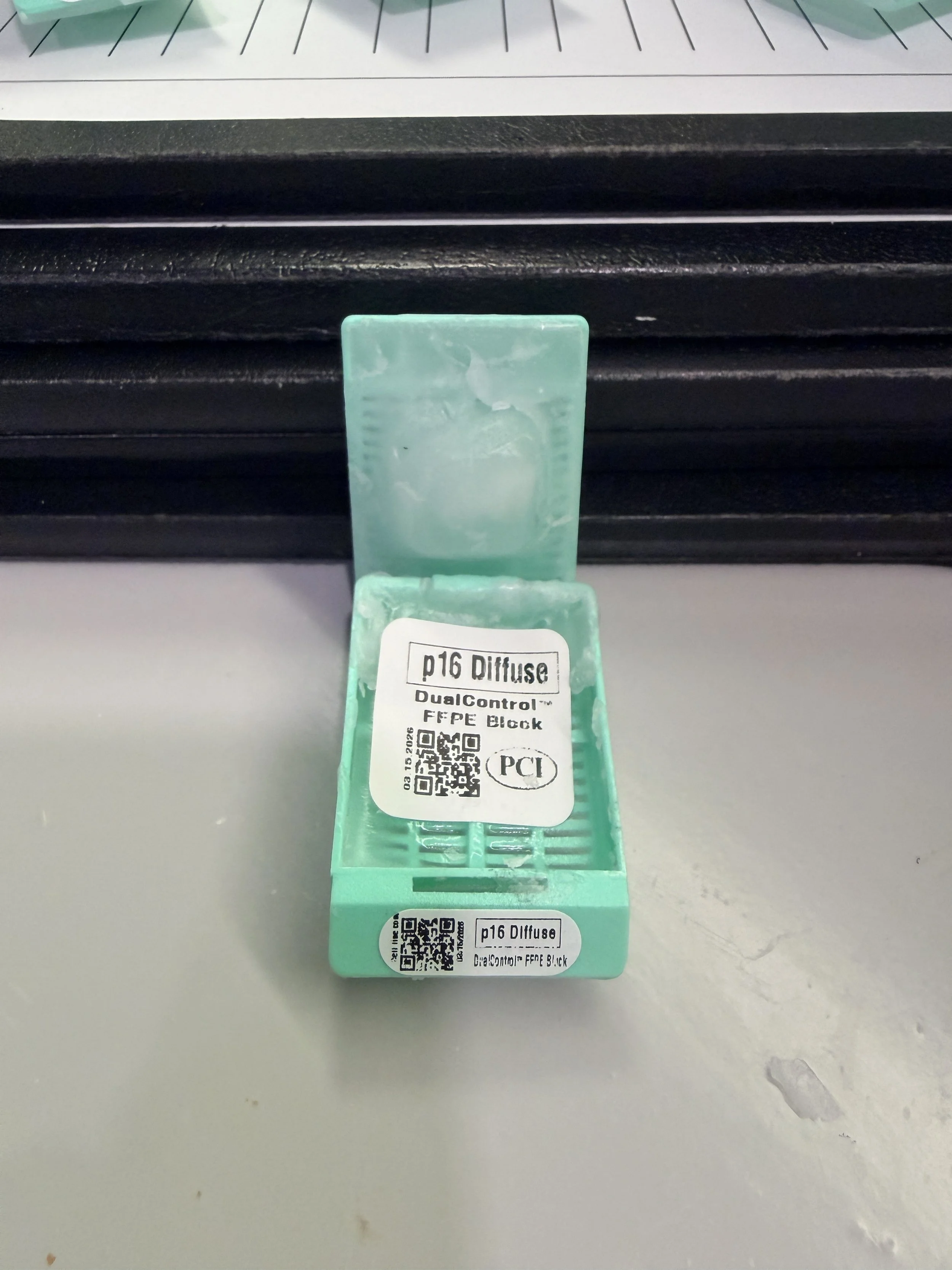 p16 Diffuse DualControl™ FFPE BLOCK