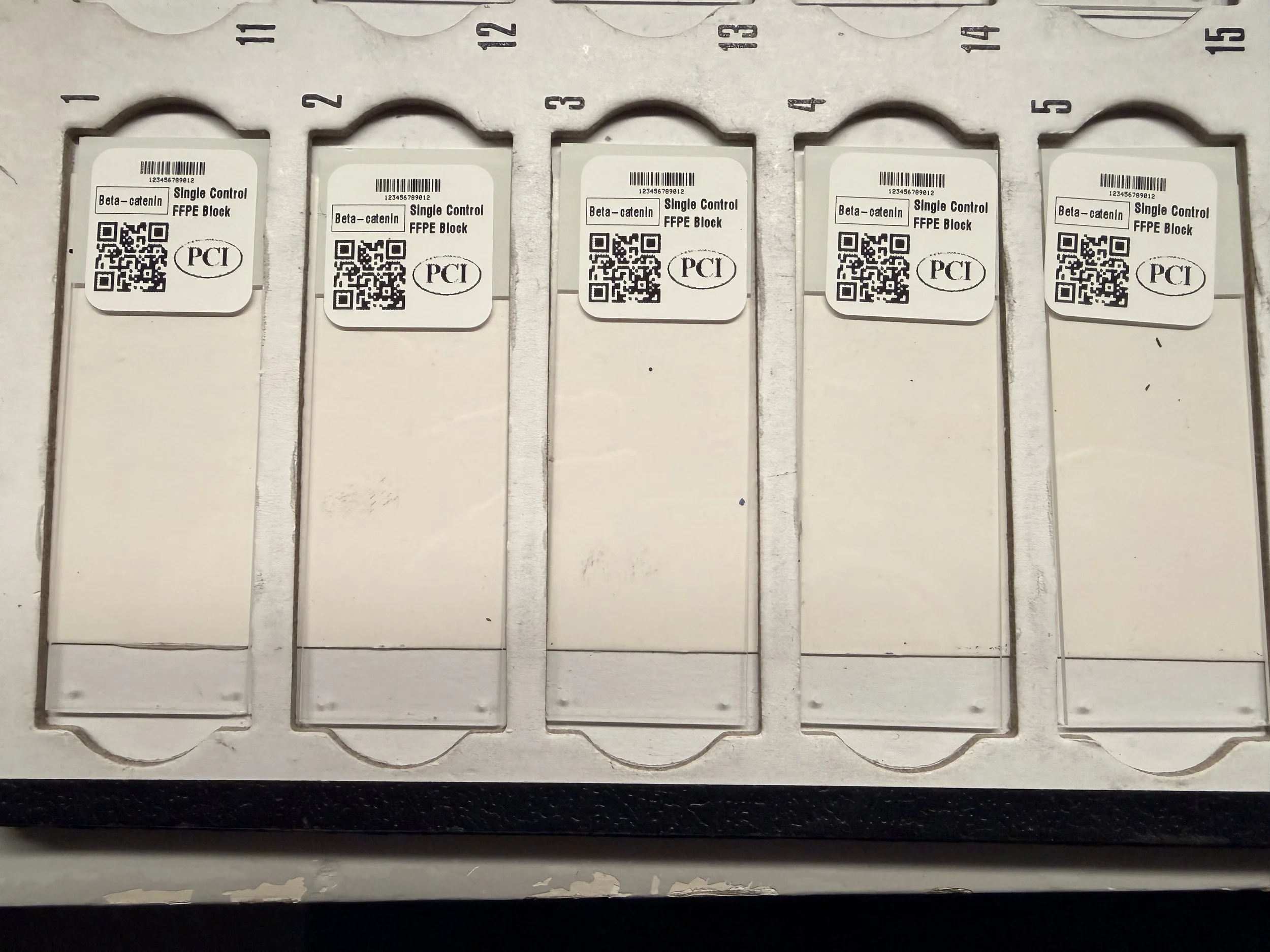 beta-catenin single control single slide.JPG