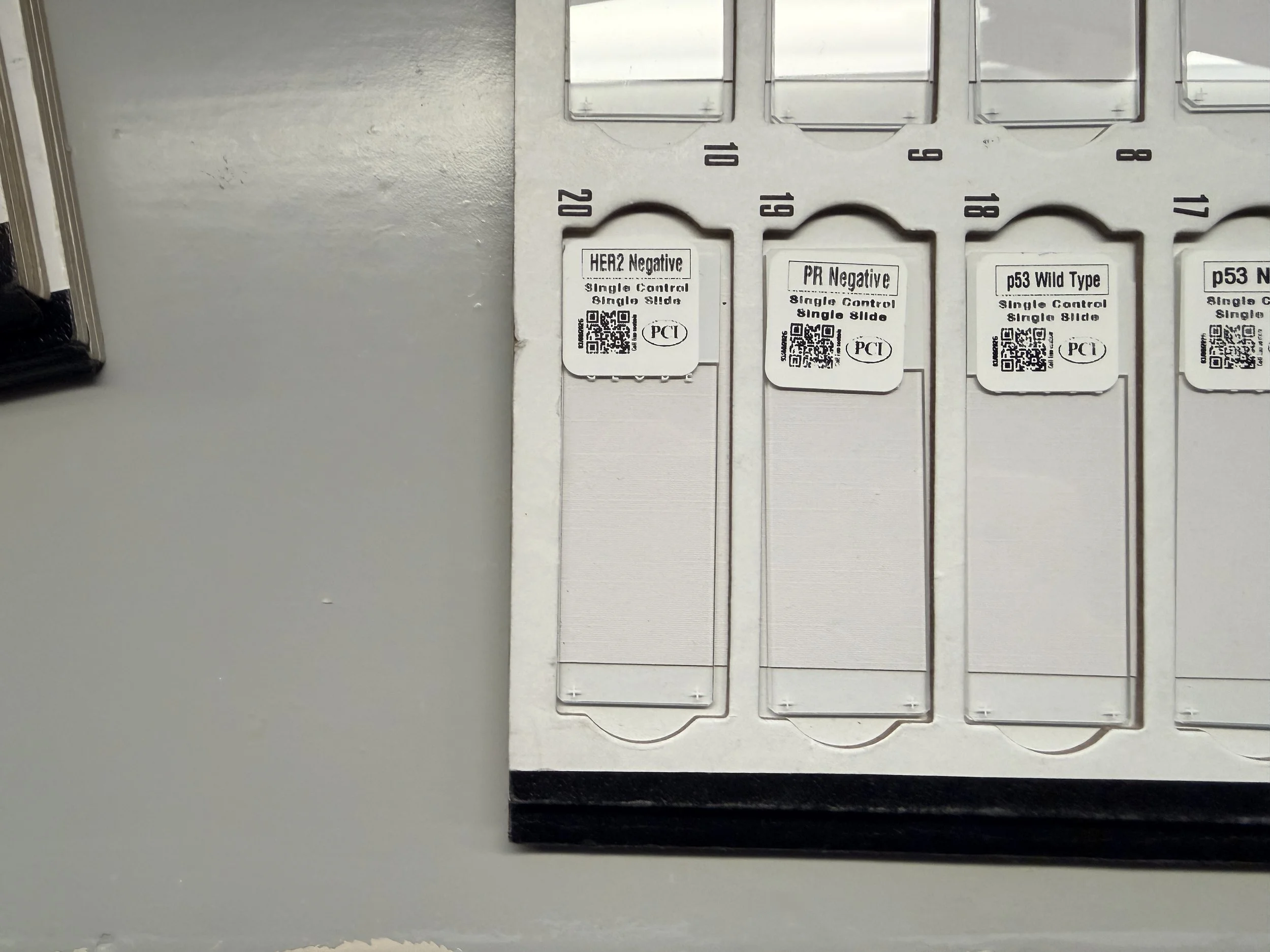 HER2 Negative.JPG