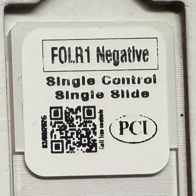 FOLR1 Negative single control single slide