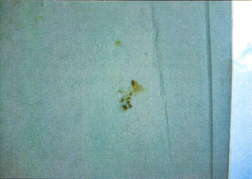 Rust-colored stains and paint blisters on a painted balcony soffit indicating moisture intrusion.