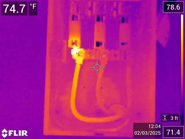 PRP Therapy (Platelet-Rich Plasma)