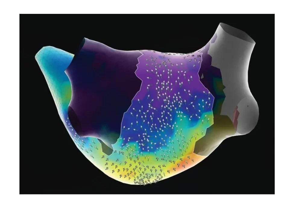 A detailed model of a human heart with colorful blood vessels displayed on a stand in a scientific setting.