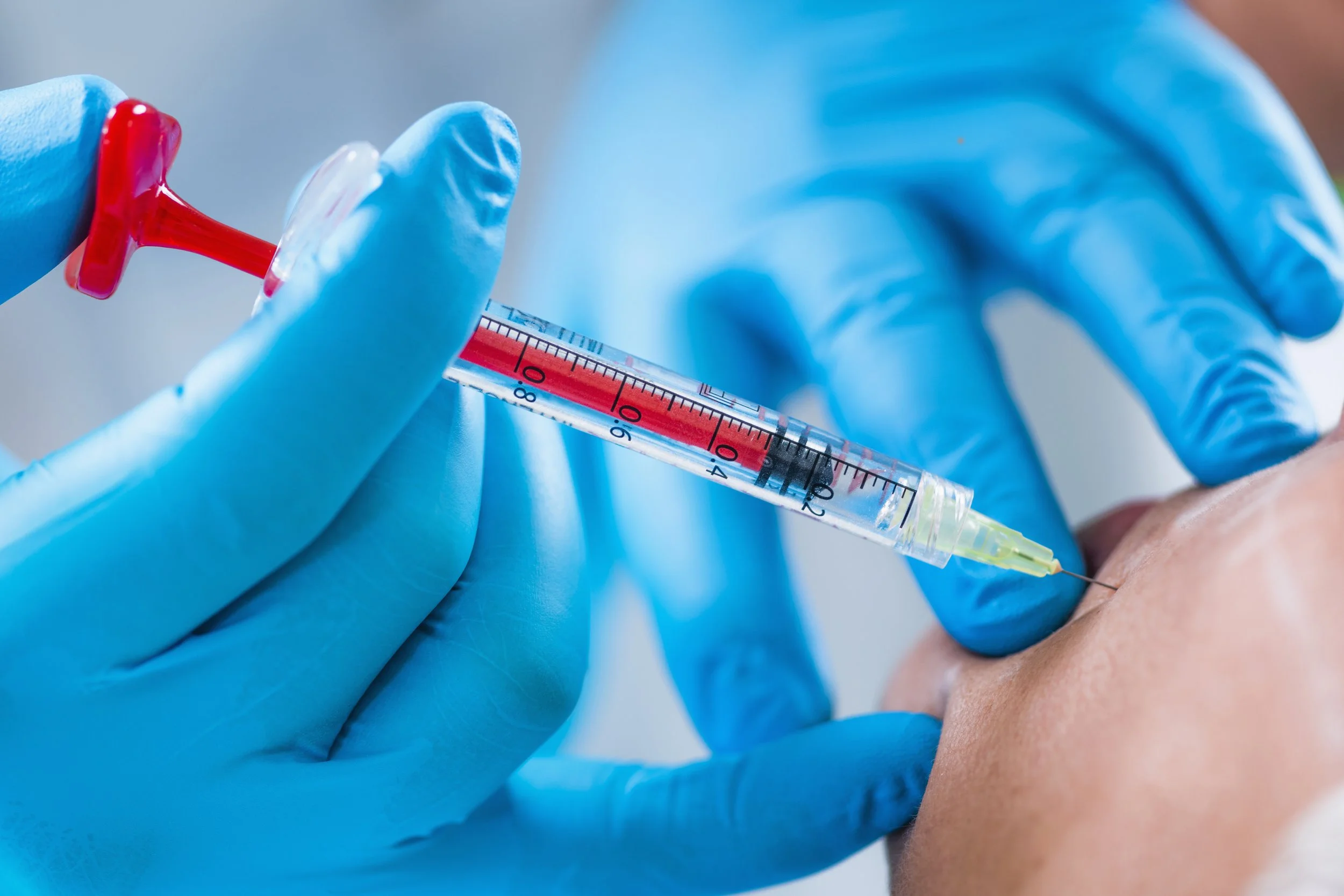 What Are  Hyaluronic Acid Skin Boosters and Do They Actually Work?
