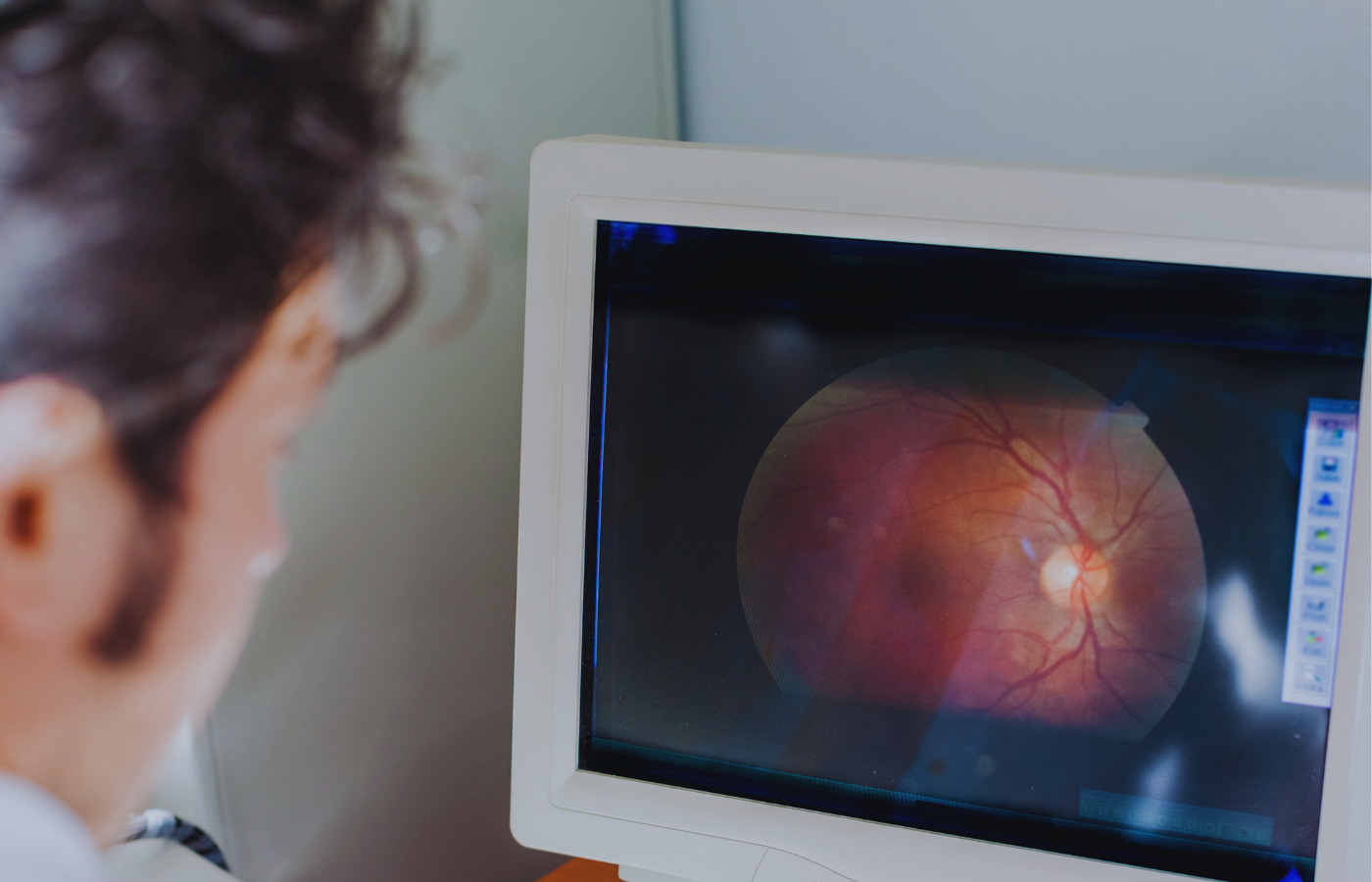 A person looking at a computer screen displaying a detailed image of a human retina, including blood vessels and the optic nerve.