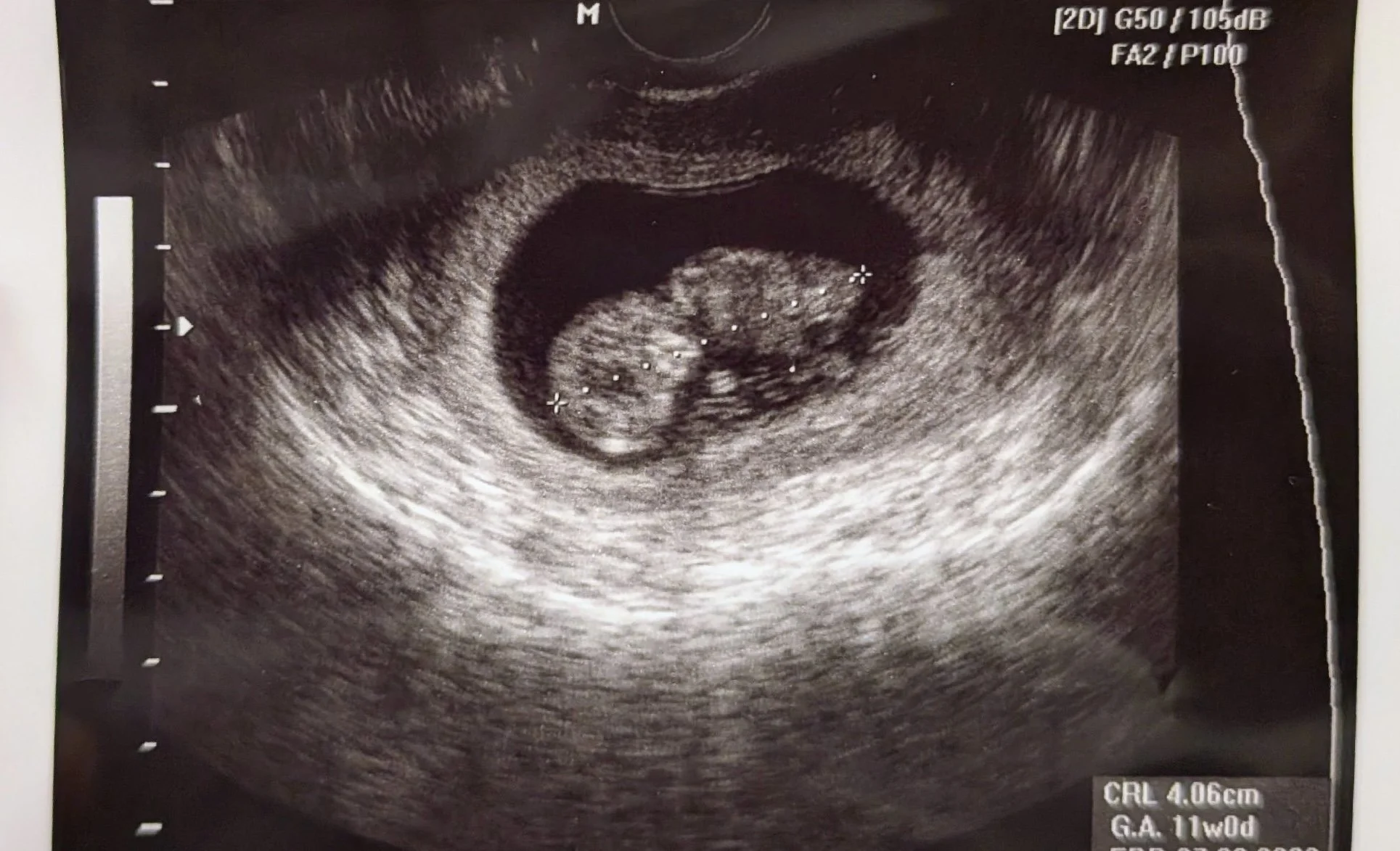 Preggo Diary: An Honest Review of My First Trimester