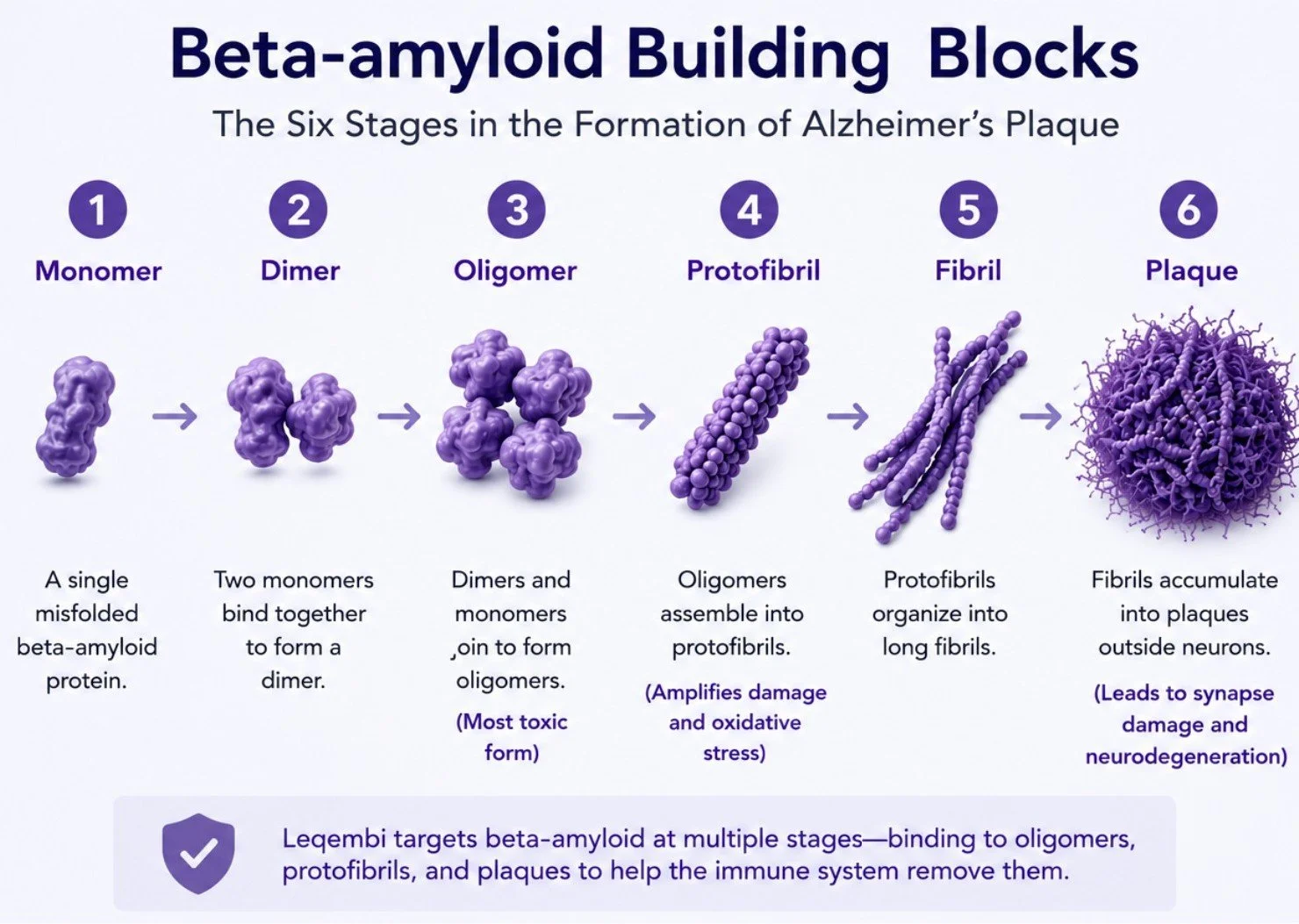 How Leqembi’s Multi-Target Strategy Fights Alzheimer’s