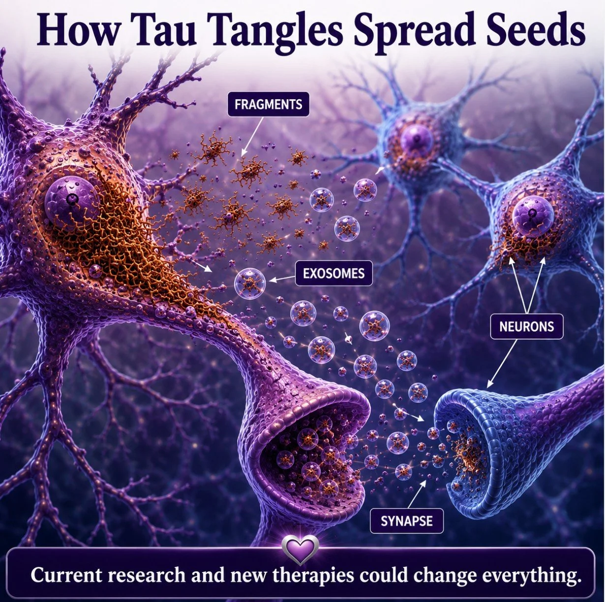 Alzheimer’s Tau Tangle Challenges
