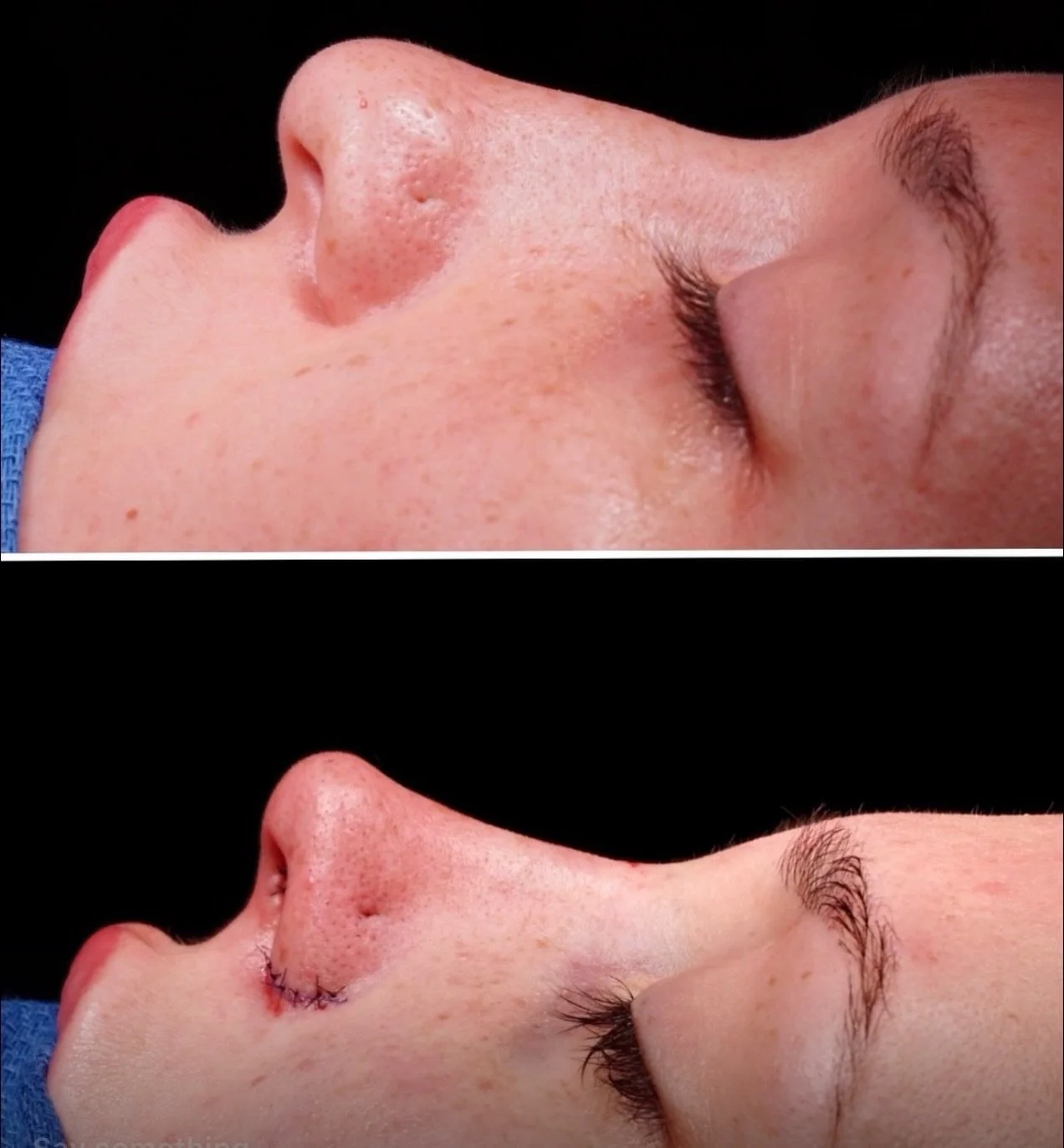 Every nose is different, because every face is unique.