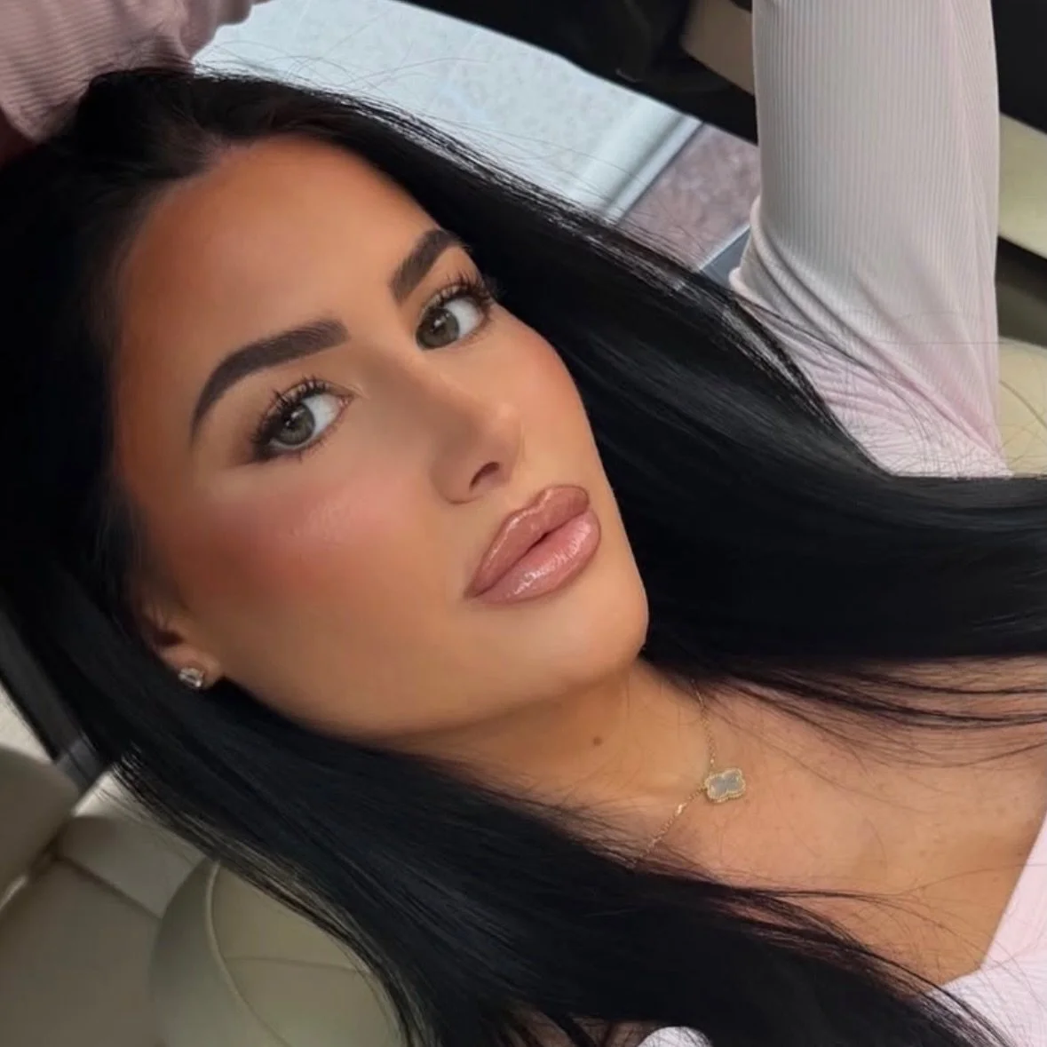 You keep putting it off&hellip; But once all healed, you&rsquo;ll post pictures like this for no reason 😁My patient, who is an aesthetic provider herself, looking fabulous months after her #rhinoplasty