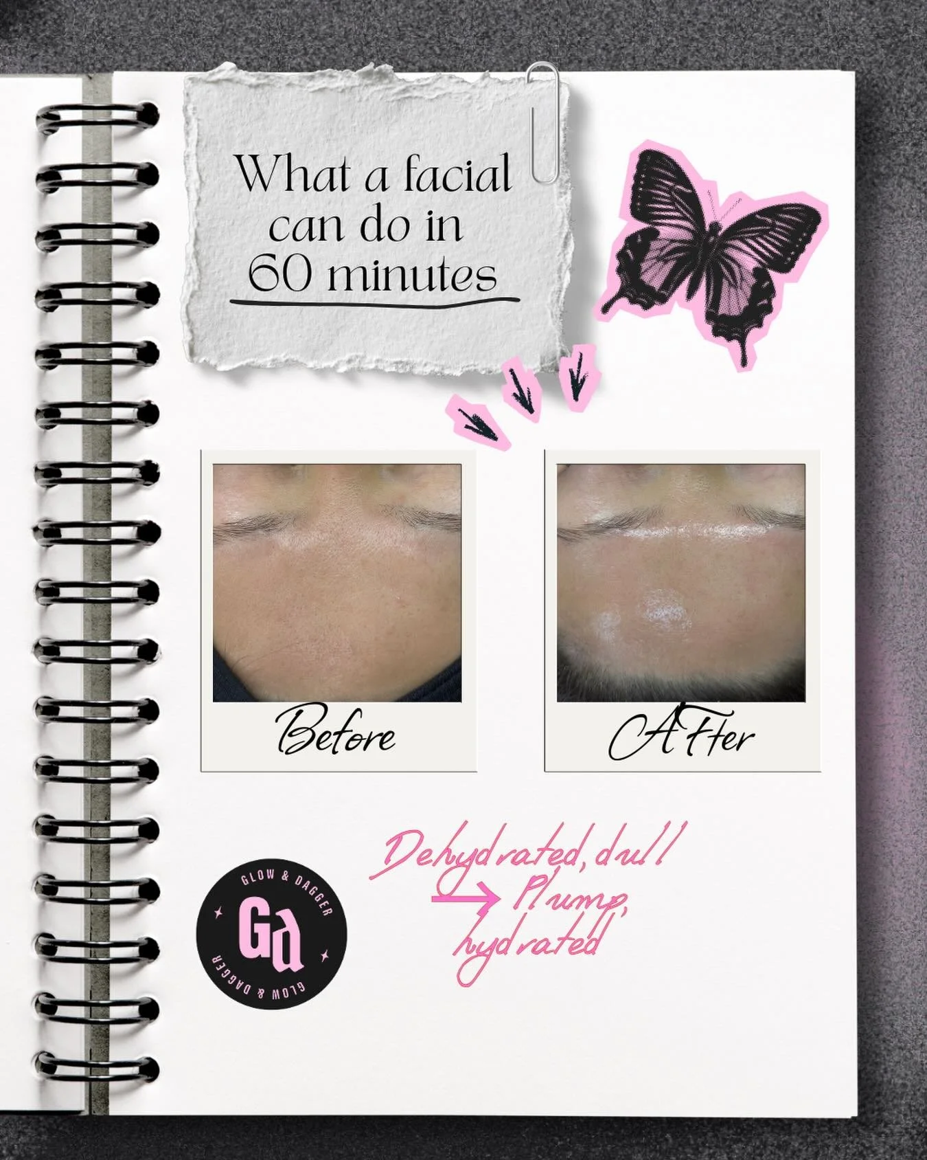 A reminder that good skin doesn&rsquo;t happen overnight.

But in 60 minutes, you can calm the skin, rehydrate it, and set it up to function better.

This session focused on hydration and barrier support to bring life back into dull, dehydrated skin.