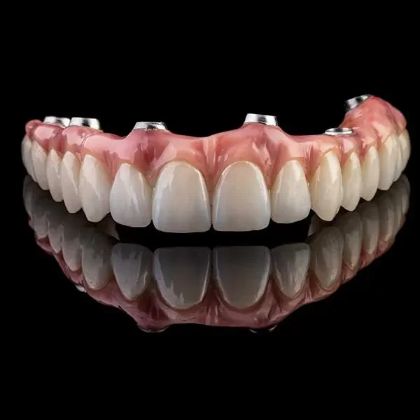 Een brug op implantaten of kunstgebit op implantaten , geplaatst op een zwarte achtergrond met een reflectie onder de tanden.