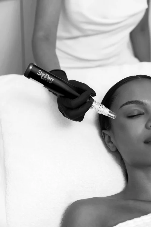 SkinPen Microneedling Sydney