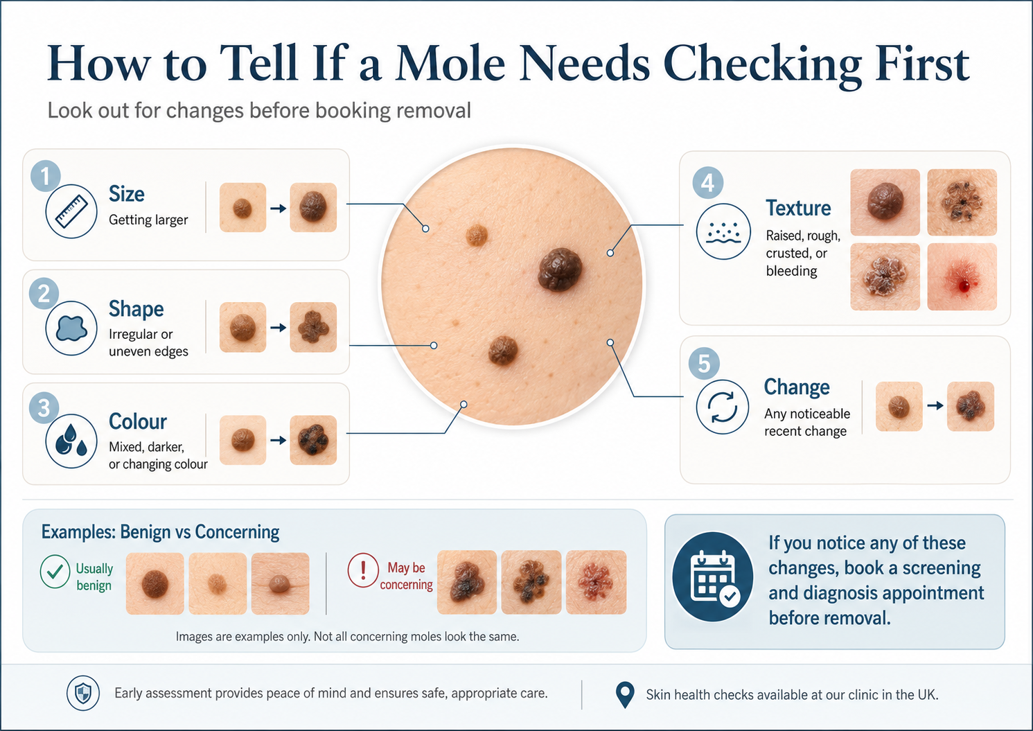 Mole Removal in Berkshire