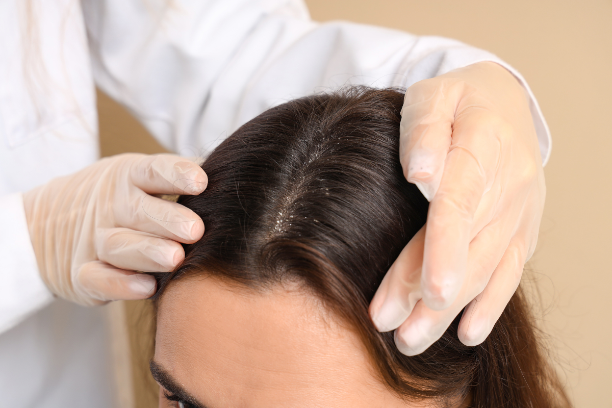a consultant holding a womans head showing the dry skin on her scalp