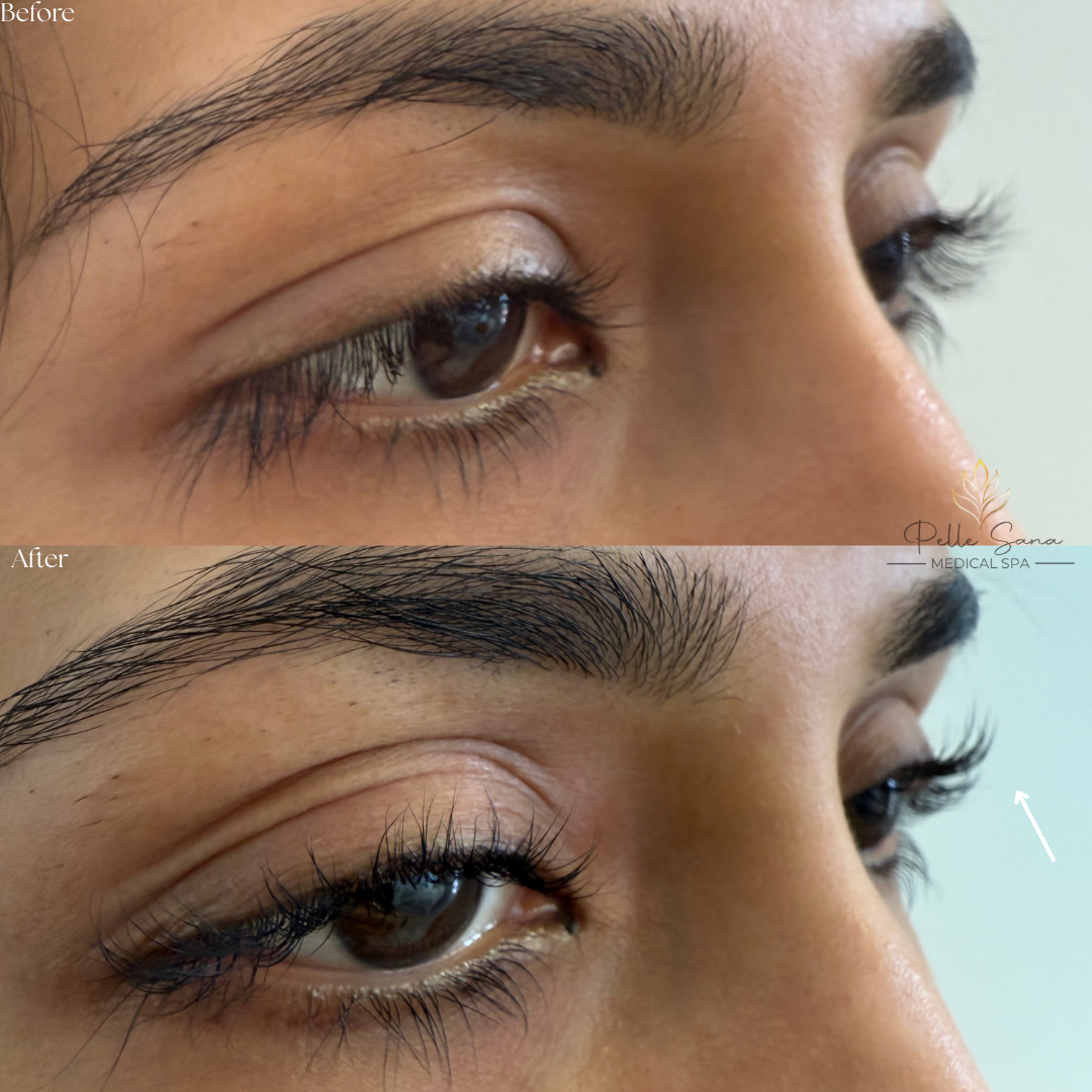 Before&Afters - 7.PNG