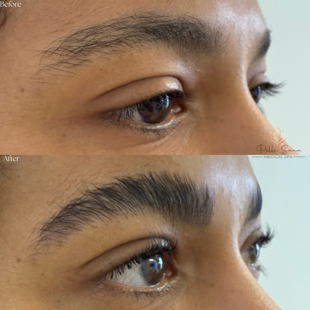 Eyebrow Lamination