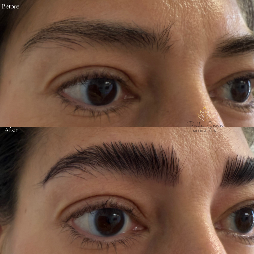 Eyebrow Lamination
