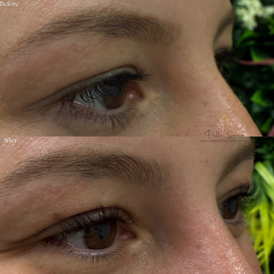 Lash Lift