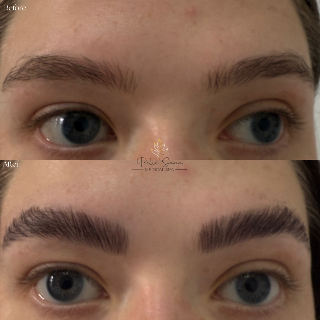 Eyebrow Lamination
