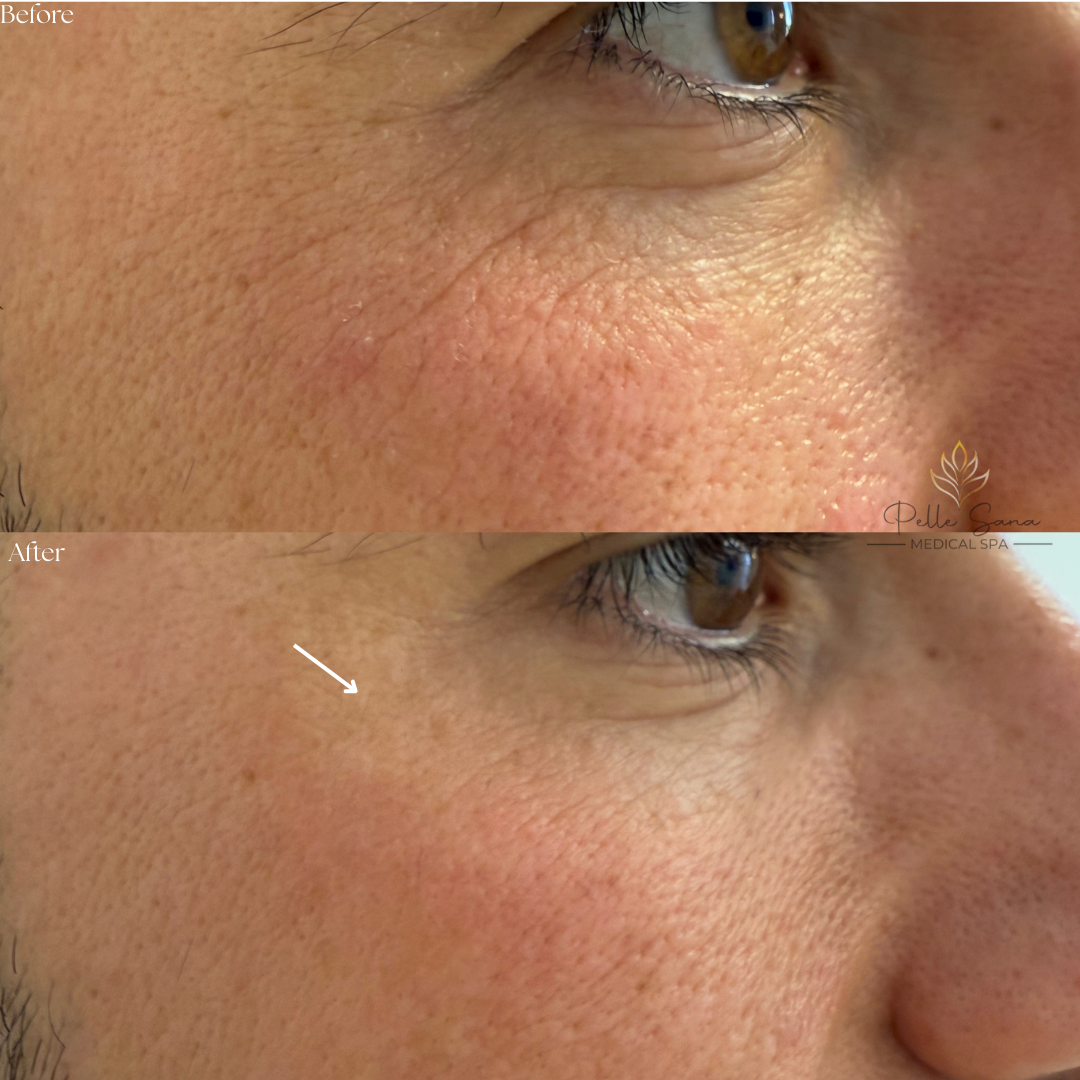 Before&Afters - 1.PNG