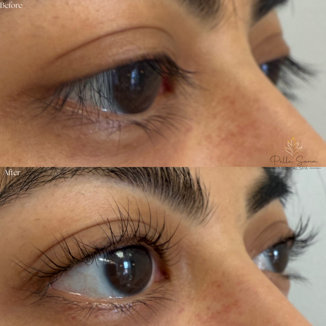 Lash Lift