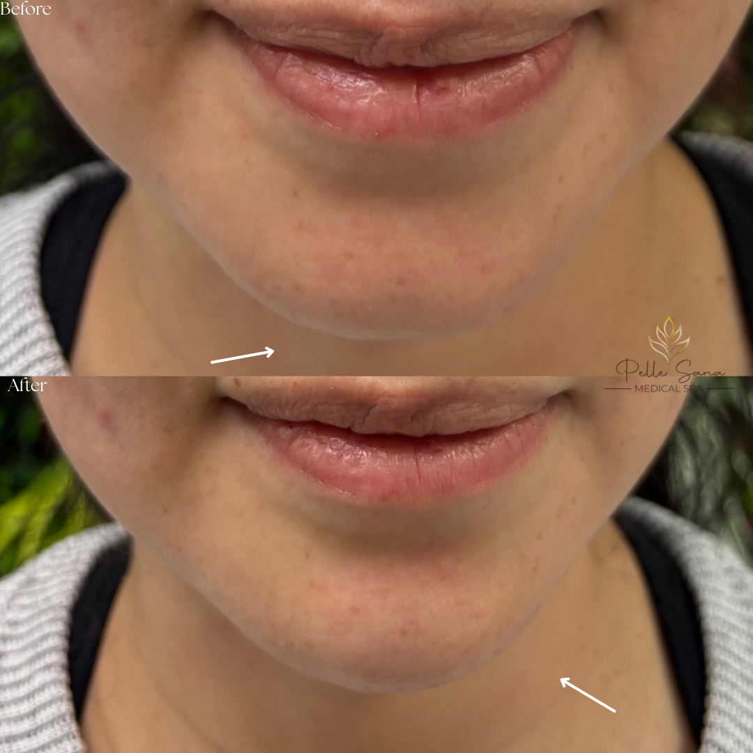 Before&Afters - 55.PNG