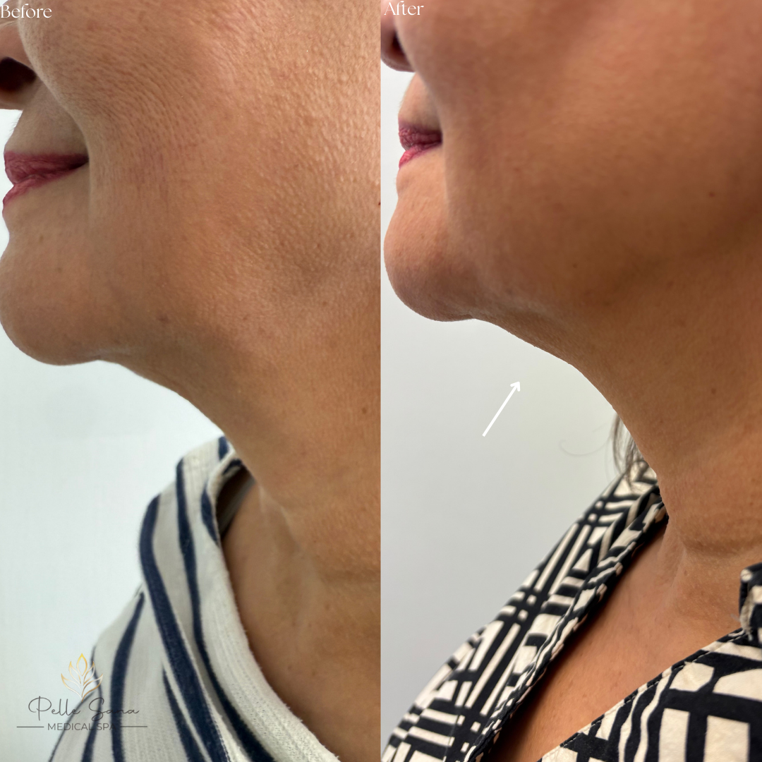 Before&Afters - 20.PNG