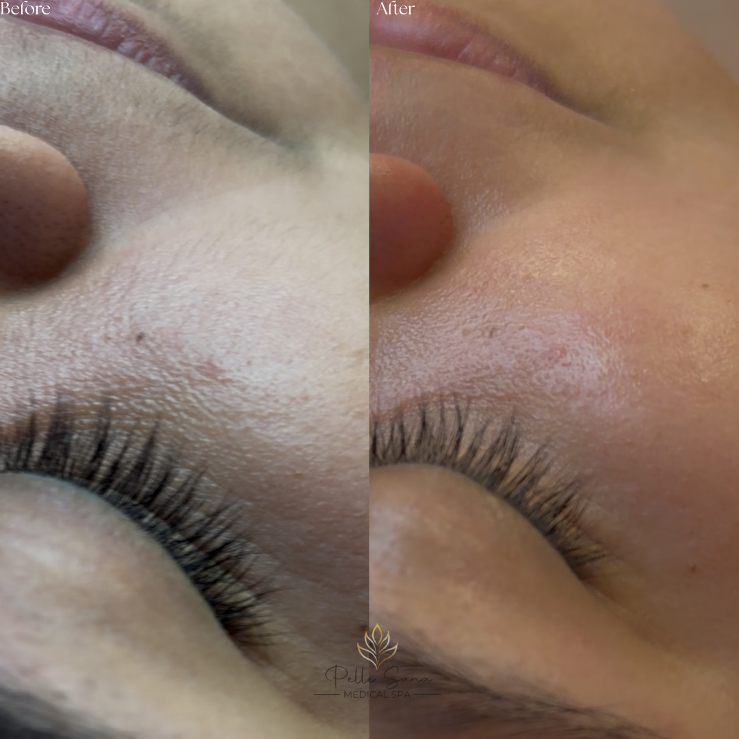 Lash Lift