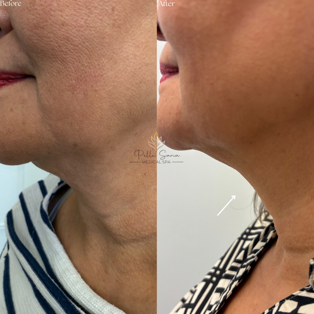 Before&Afters - 22.PNG