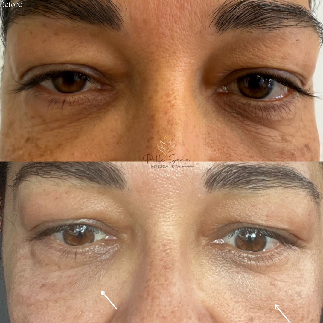 Before&Afters - 8.PNG