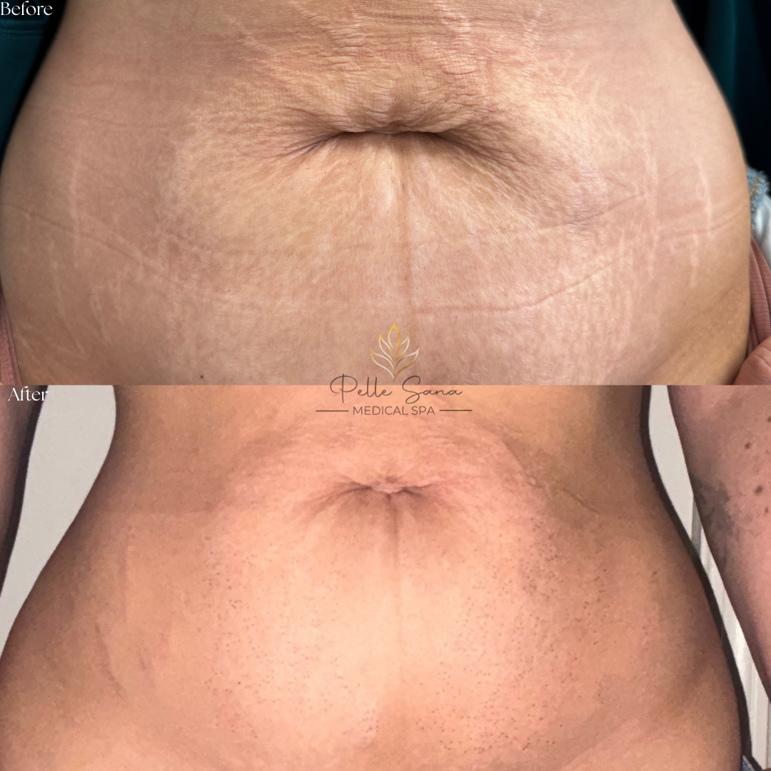 Before&Afters - 10.PNG