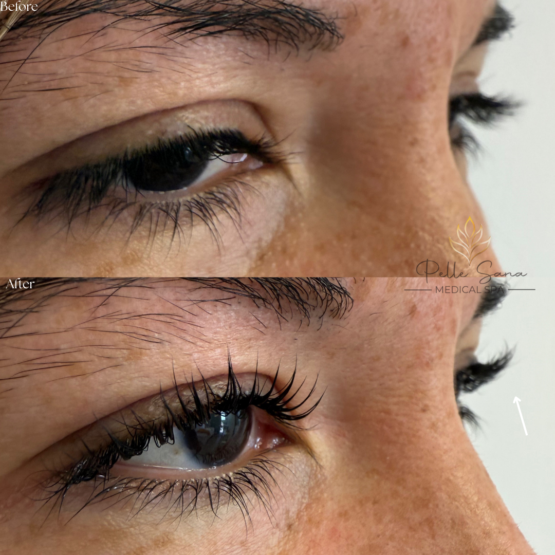 Lash Lift