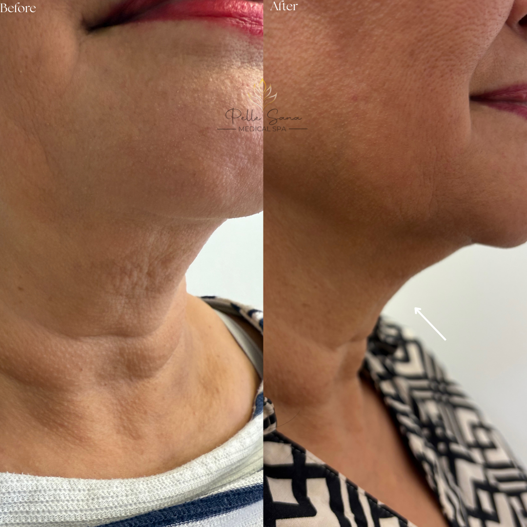 Before&Afters - 21.PNG