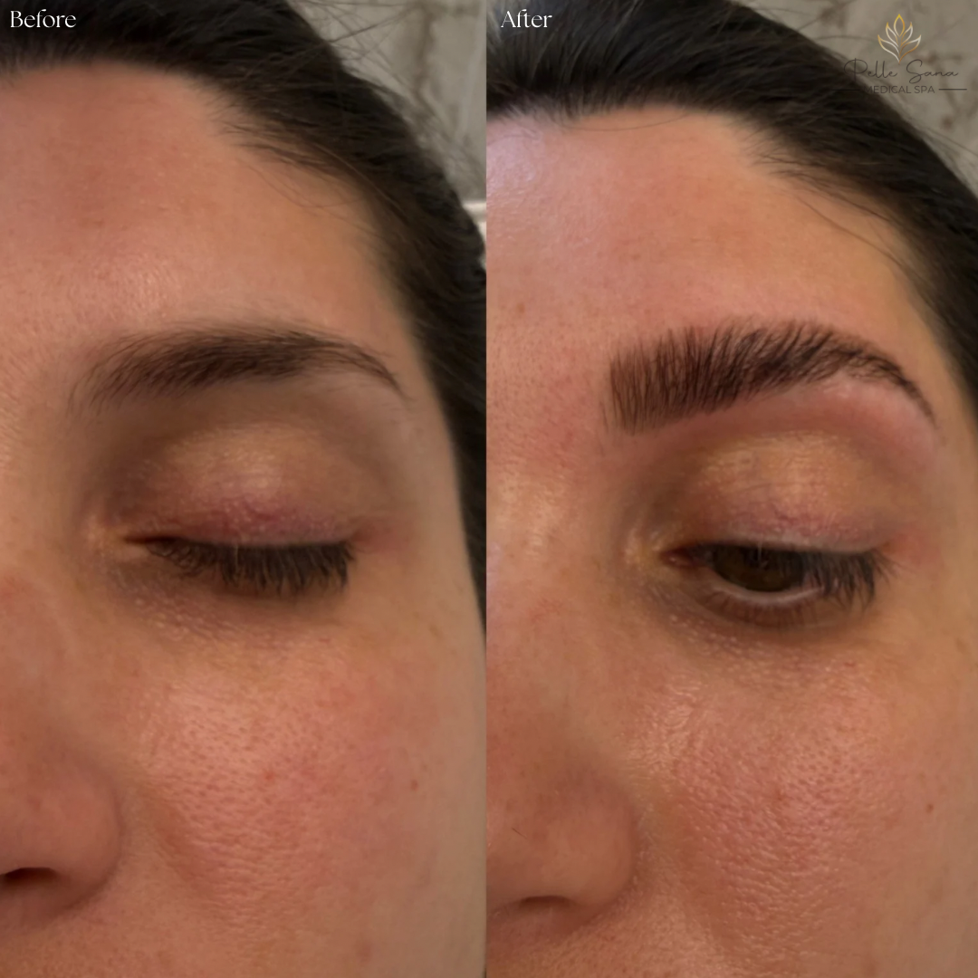 Eyebrow Lamination