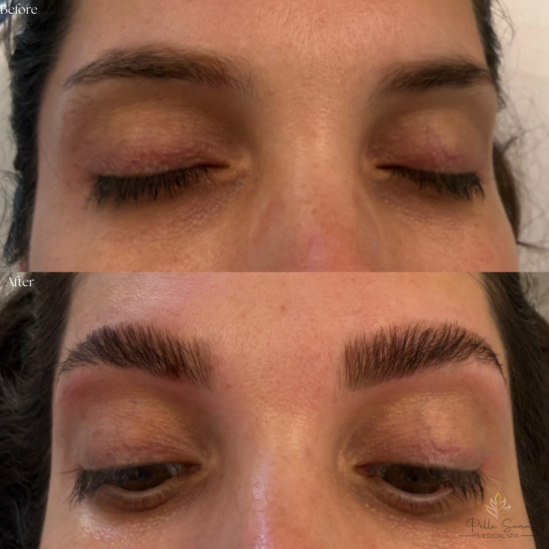 Eyebrow Lamination